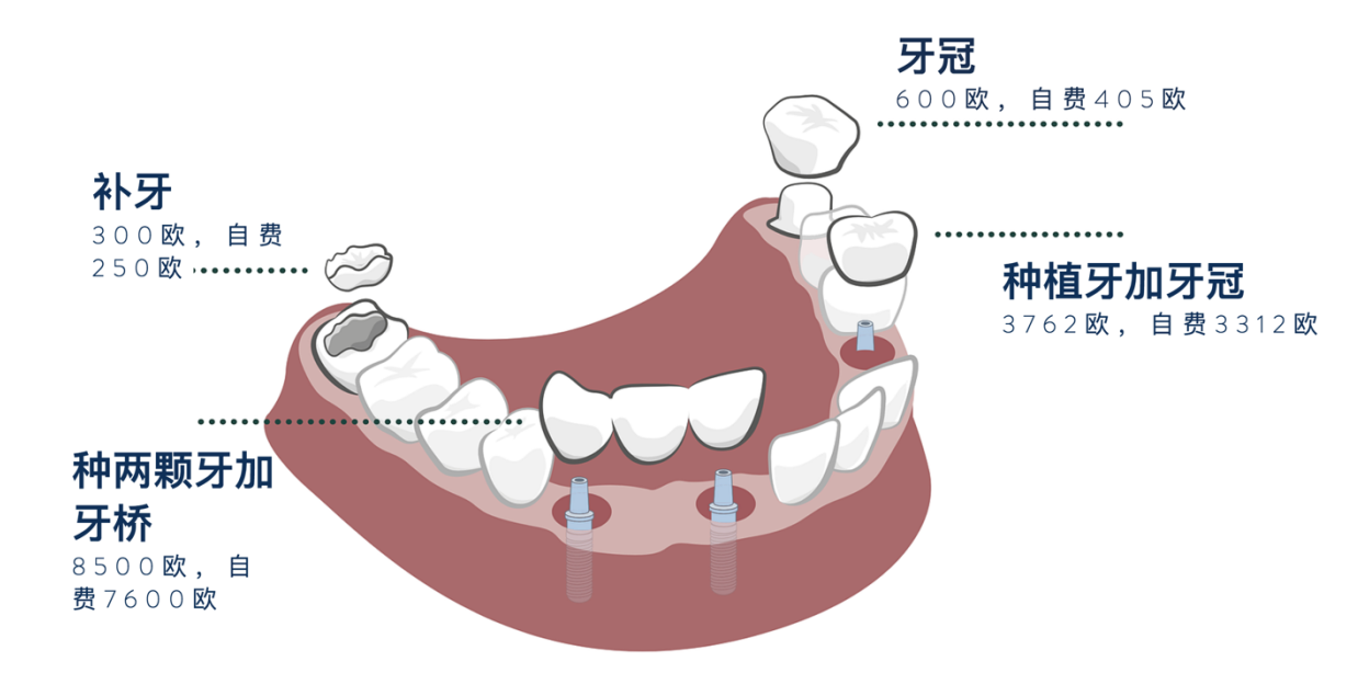 德国牙齿附加险.png